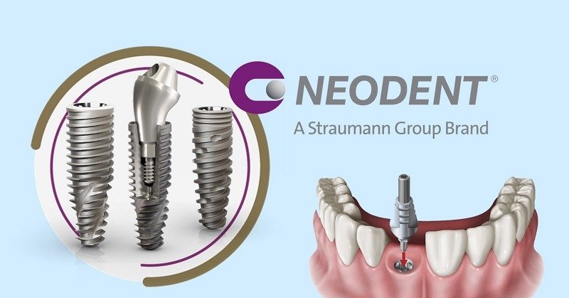 Когда рекомендуется имплантация Neodent