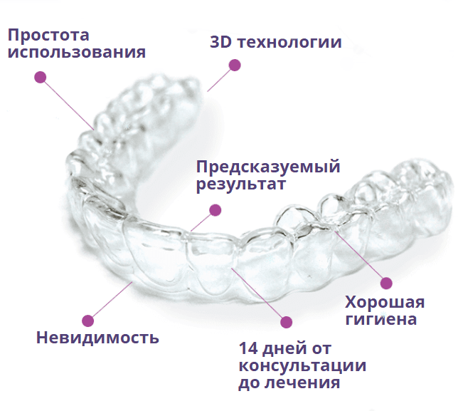элайнеры для зубов