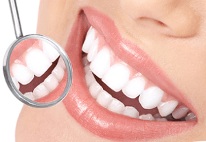 Красота или здоровье: процедура отбеливания зубов