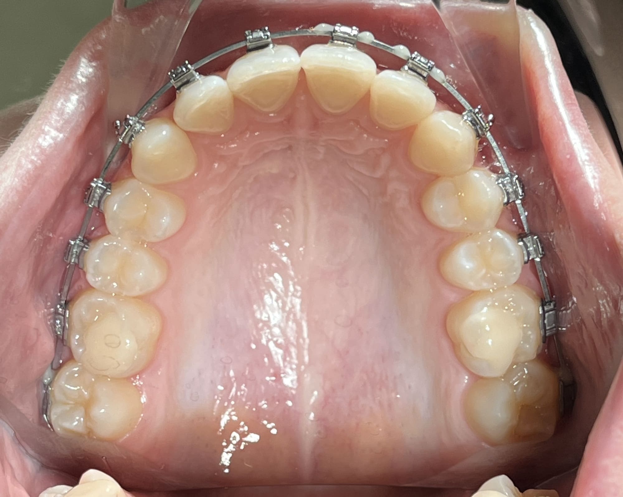 промежуточный результат