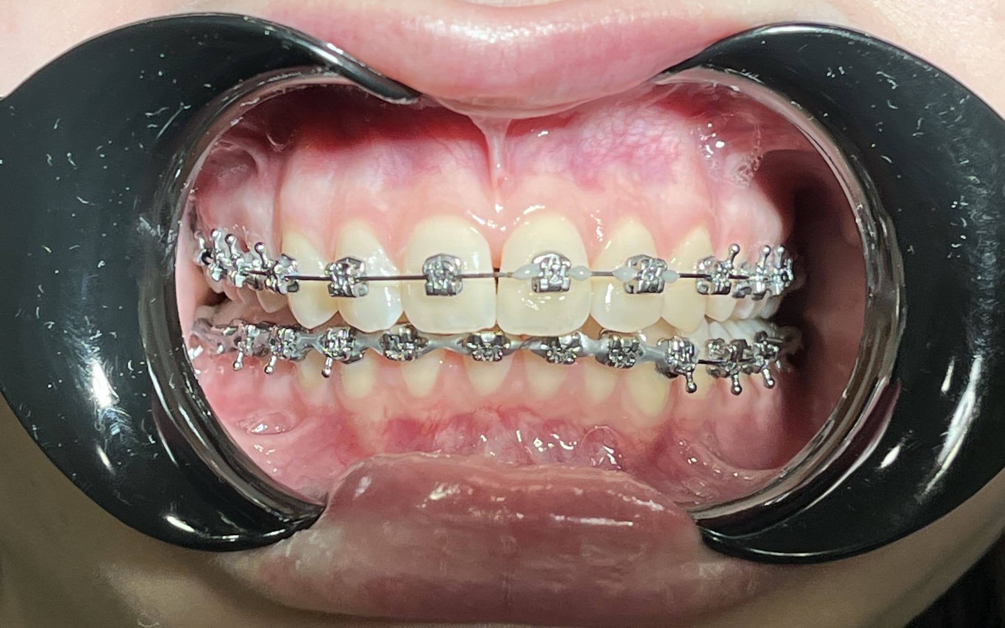 пациент после