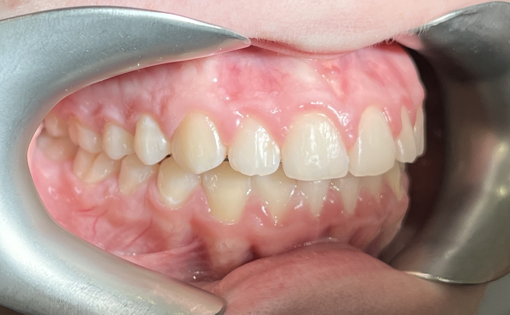 пациент после