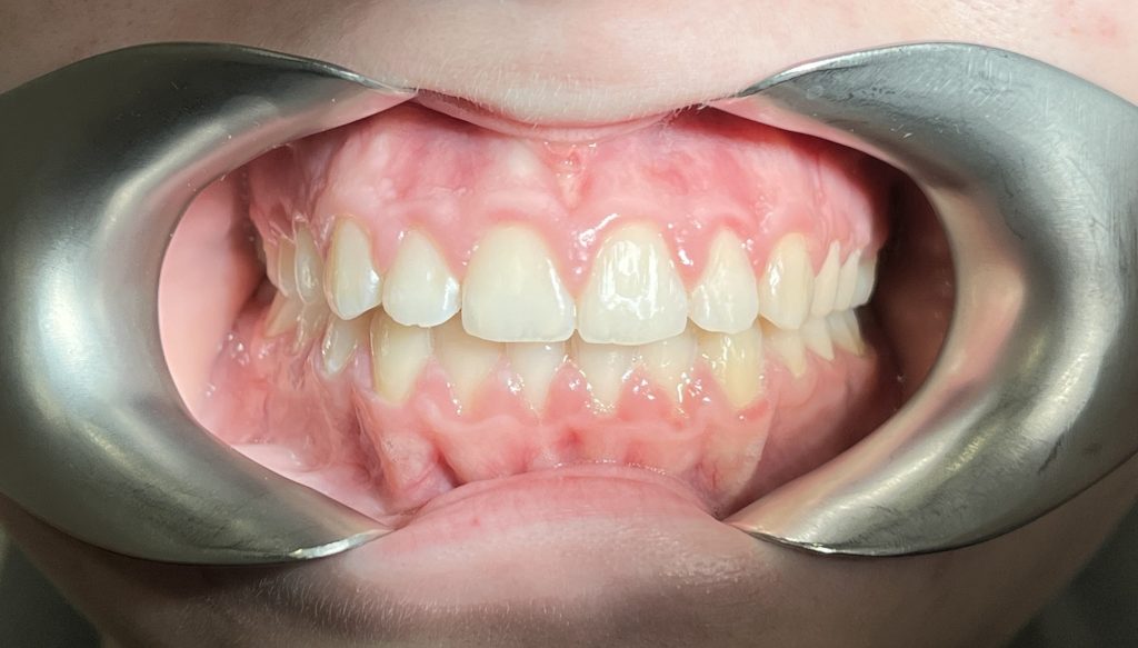 пациент после