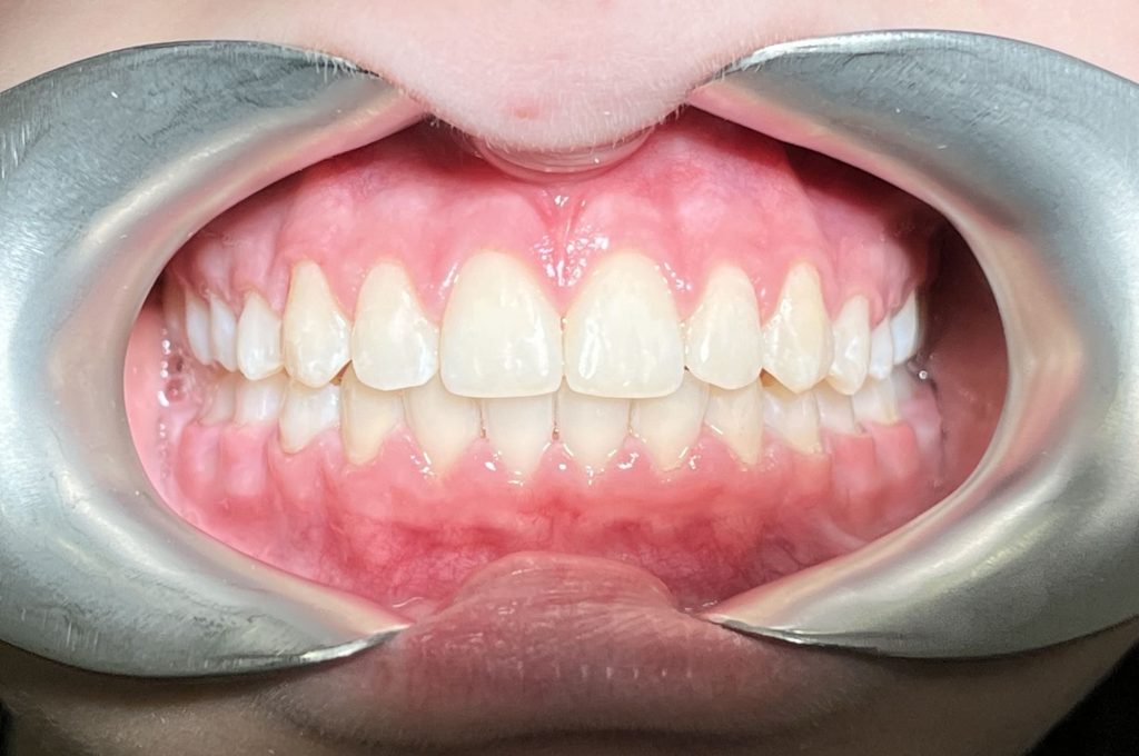 пациент после