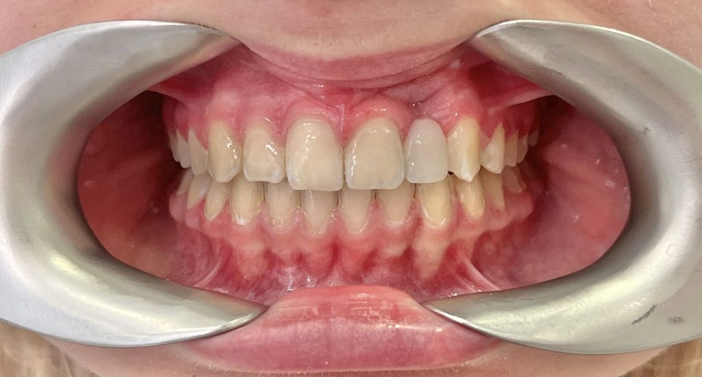 пациент после