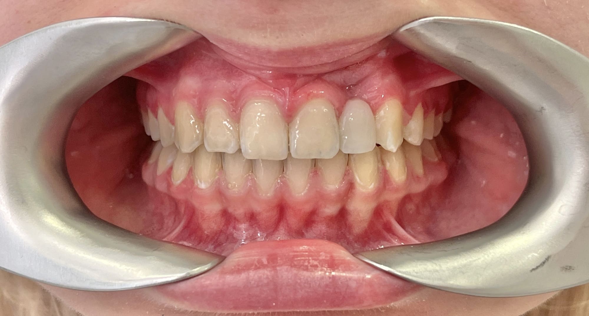 пациент после