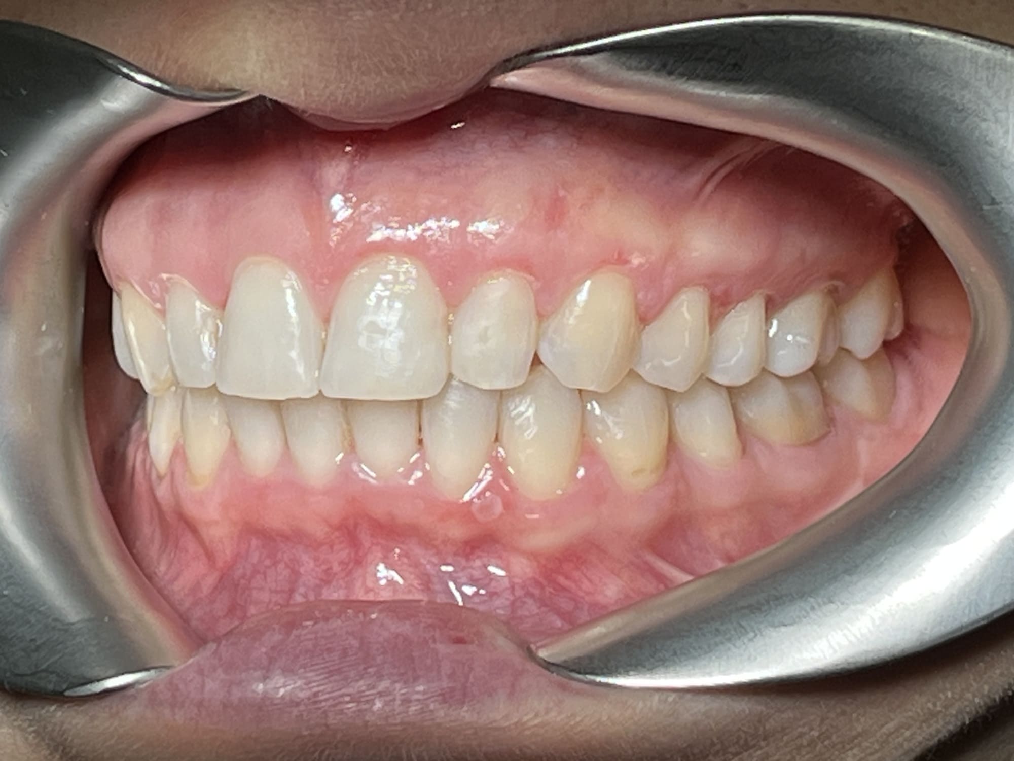 пациент после