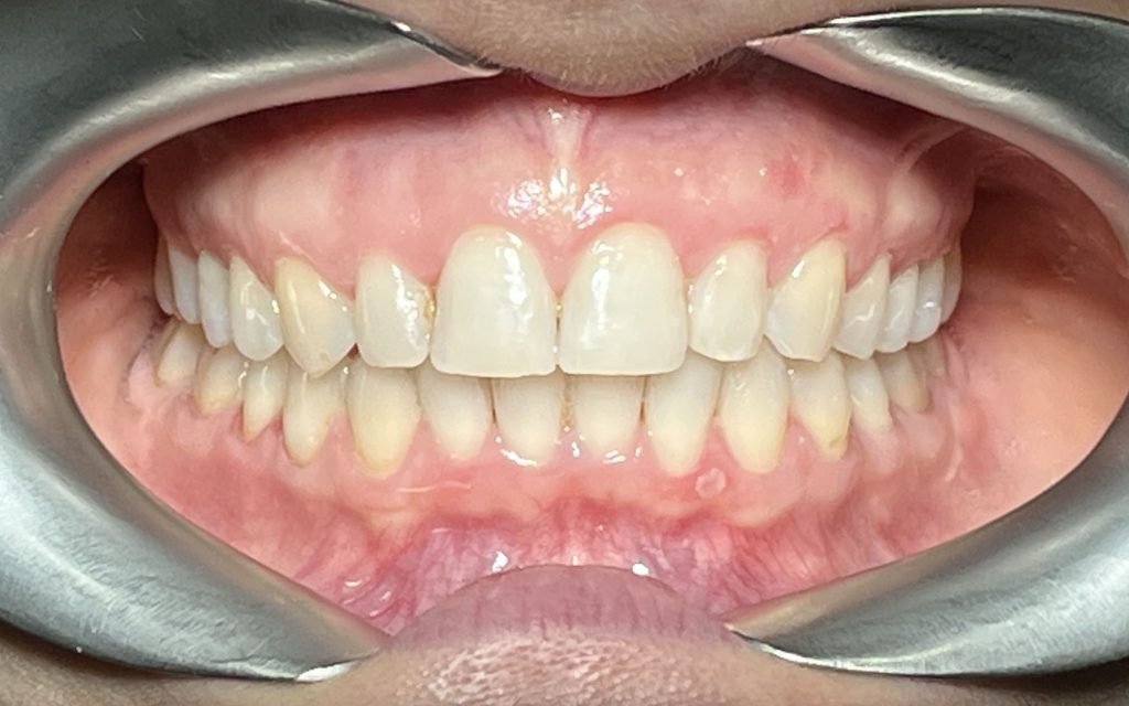 пациент после