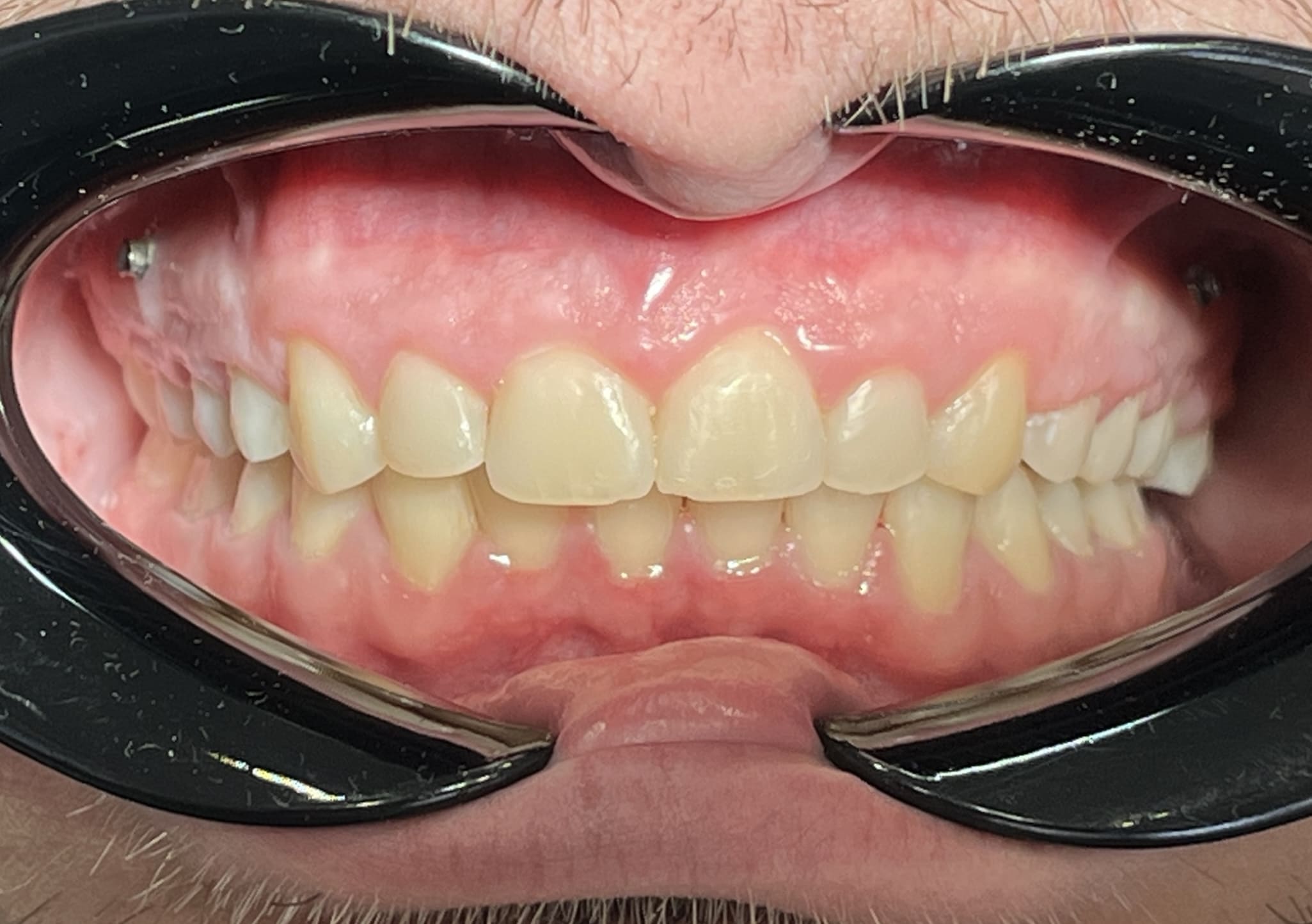 пациент после