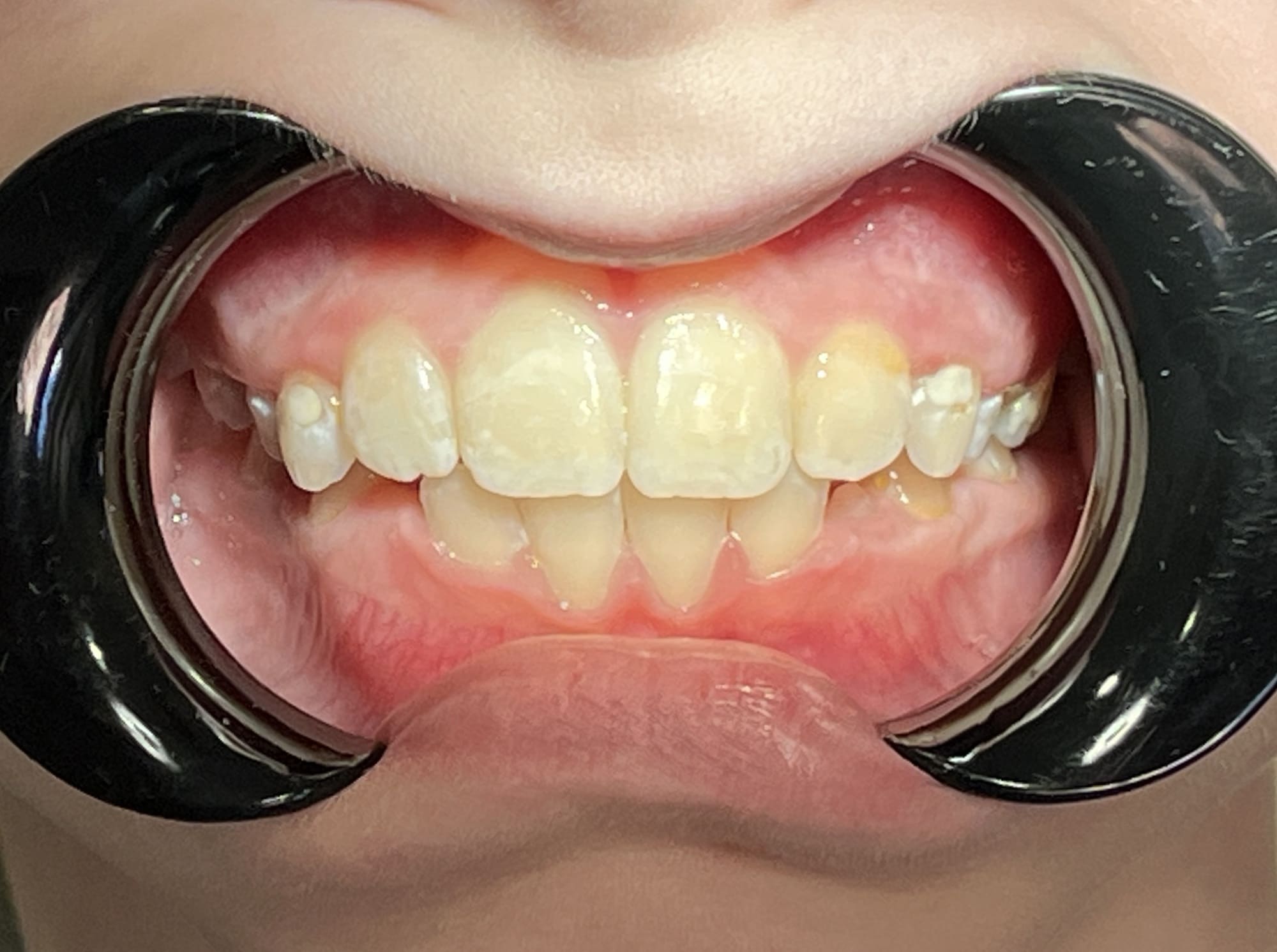 пациент после