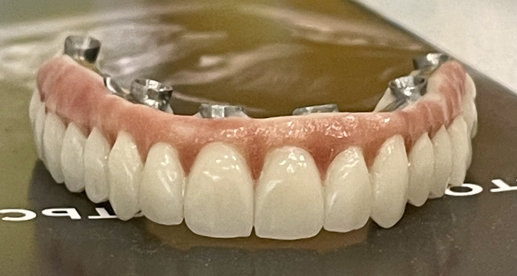 протез на импланте