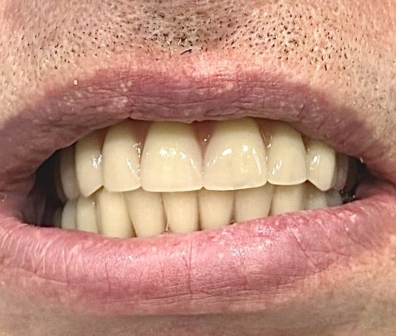 пациент после