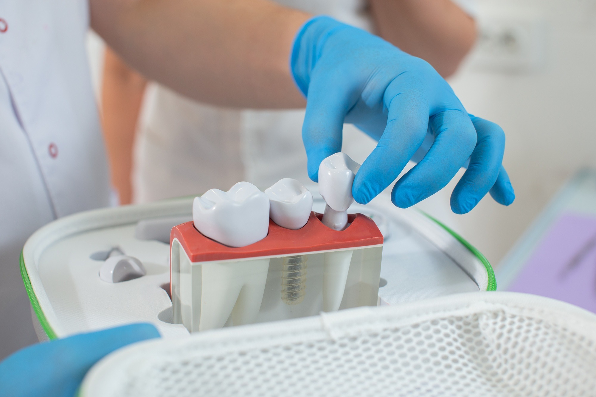 Истории пациентов: как премиум-протезирование меняет качество жизни