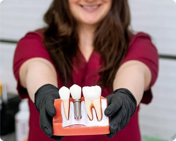 установка импланта зуба