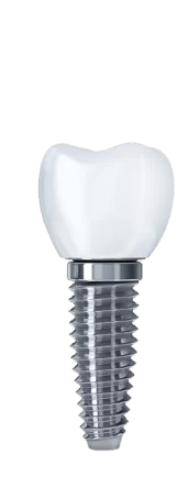 имплантация зубов цена